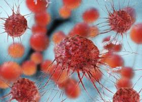 Los casos de cáncer aumentan un 15% en cinco años Los casos de cáncer aumentan un 15% en cinco años