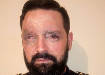 La Audiencia Nacional rechaza indemnizar a un herido por la explosión de unas minas