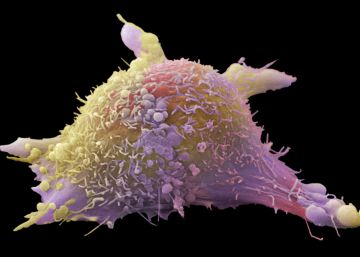El 53% de las personas con cáncer en España se cura
