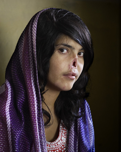 FOTOGALERIA: El retrato de Aisha, World Press Photo 2011