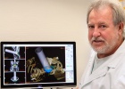 Un sistema permite predecir el efecto de la radioterapia