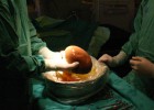 España bate su récord con 36 trasplantes en 24 horas