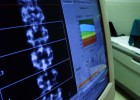 Biotecnología contra la osteoporosis