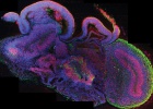 Creados microcerebros humanos a partir de células madre