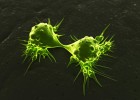Más cáncer pero menos muertes