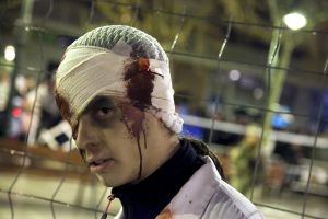 Un joven disfrazado de muerte viviente.