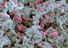 Os antibióticos perdem eficácia no mundo todo