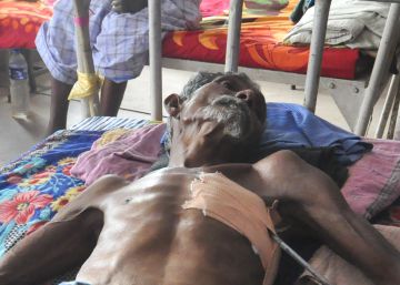 La vacuna de la tuberculosis da su primer salto eficaz en un siglo