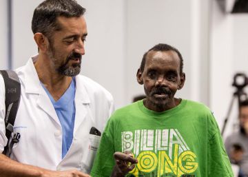 El doctor Cavadas reconstruye la cara y la mano a un hombre atacado por una hiena