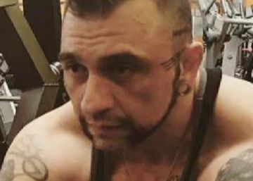 La novia del hombre que viajó de Italia a Tenerife fue quien vertió el ácido sobre la víctima