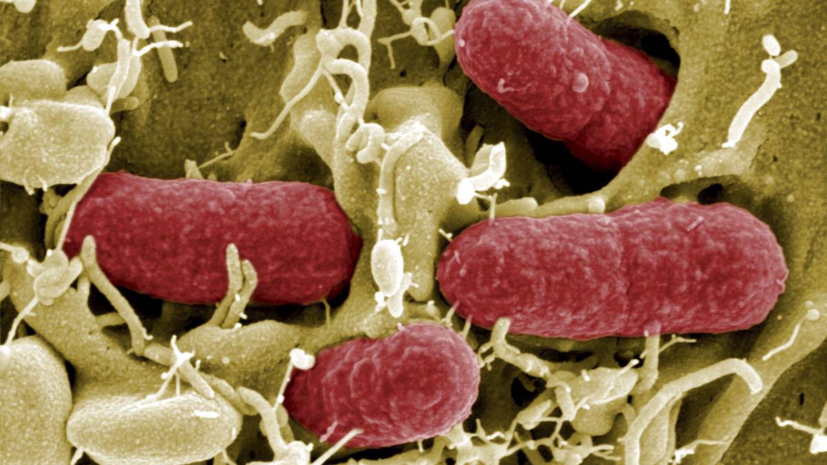 Colonia de bacterias en un ser vivo.
