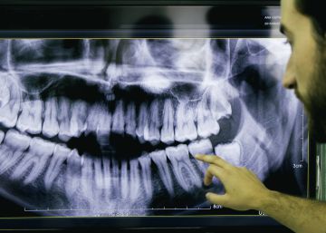 Si ha detectado carencias en la sanidad, contacte con nosotros en sanidadpublica@elpais.es
