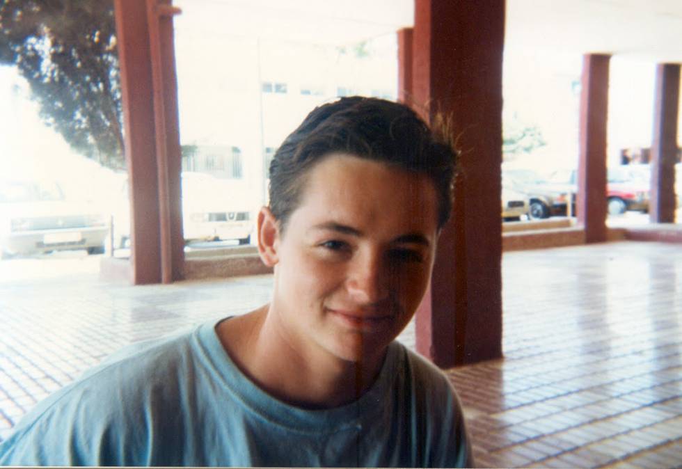 Manuel, antes de implantarse.