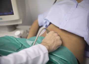 La diabetis gestacional creix un 70% en deu anys