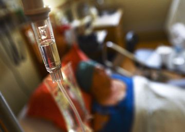 Quimioterapia en aerosol a presión para tumores del peritoneo