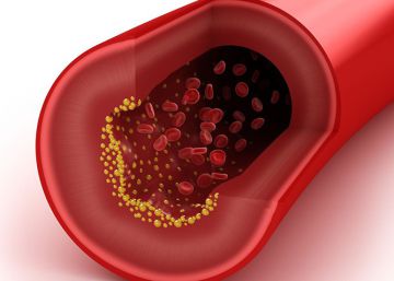 Identificada una proteína que cuadruplica el riesgo cardiovascular
