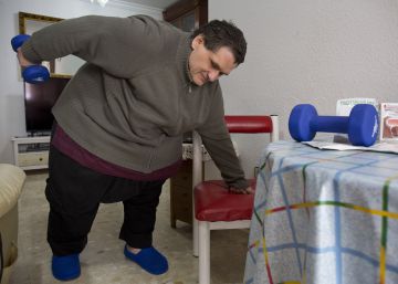 El peso psicológico tras una reducción de estómago