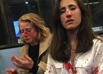Cinco adolescentes são detidos por ataque homofóbico a casal de mulheres em Londres