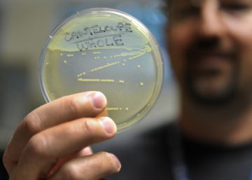 La listeria, el mayor peligro de la cocina, mata a 70 personas al año