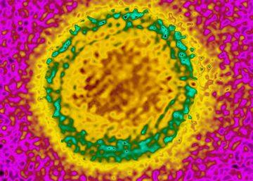 Diagnosticado en Madrid uno de los primeros casos de transmisión sexual de dengue en el mundo