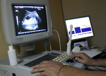 Los abortos registran un ligero repunte por segundo año consecutivo