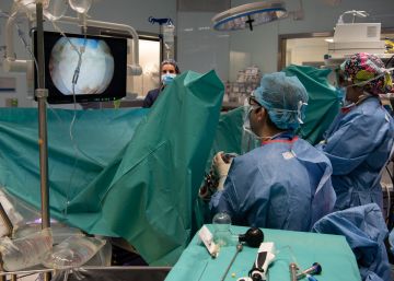 El 3D entra en la cirurgia de pròstata més comuna per primera vegada