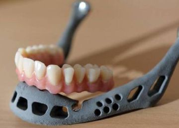 Un niño chino recibe el primer trasplante de una mandíbula creada con una impresora 3D