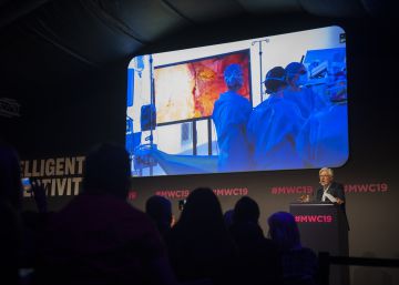 Una operació de còlon es converteix en la primera intervenció quirúrgica en 5G
