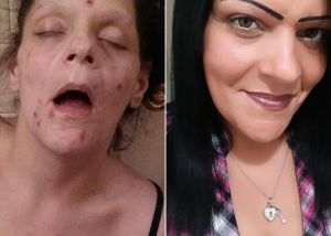 Ex-viciada publica fotos de seu pior momento: “A heroína destruiu minha vida” Ex-viciada publica fotos de seu pior momento: “A heroína destruiu minha vida”