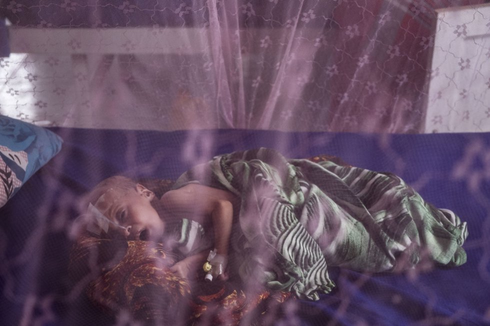 Fatima levou seu filho Hadid, de apenas cinco meses, ao hospital à beira da morte. Ela não tinha absolutamente nada para alimentá-lo. Na Somália, 275.000 crianças sofrem com desnutrição aguda severa por culpa da seca que arrasou a criação de gado e as escassas plantações. Hadid recebe tratamento nutricional em um hospital de Garowe, em Puntlandia, no norte do país.