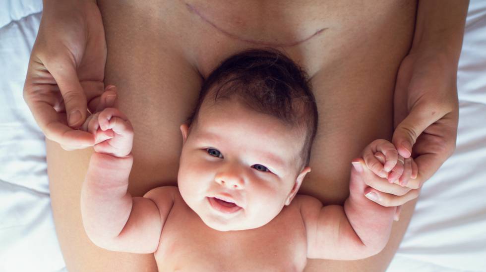 A ferida emocional deixada pelas cesáreas
