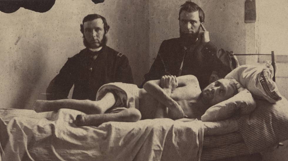 O cabo Calvin Bates no hospital, após sair de um campo de prisioneiros dos confederados em Andersonville.