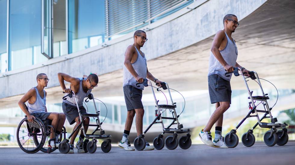 Paraplégicos voltam a andar após implante de eletrodo