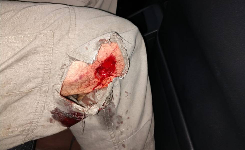 Daniel Arroyo foi atingido no joelho direito por uma bala de borracha 