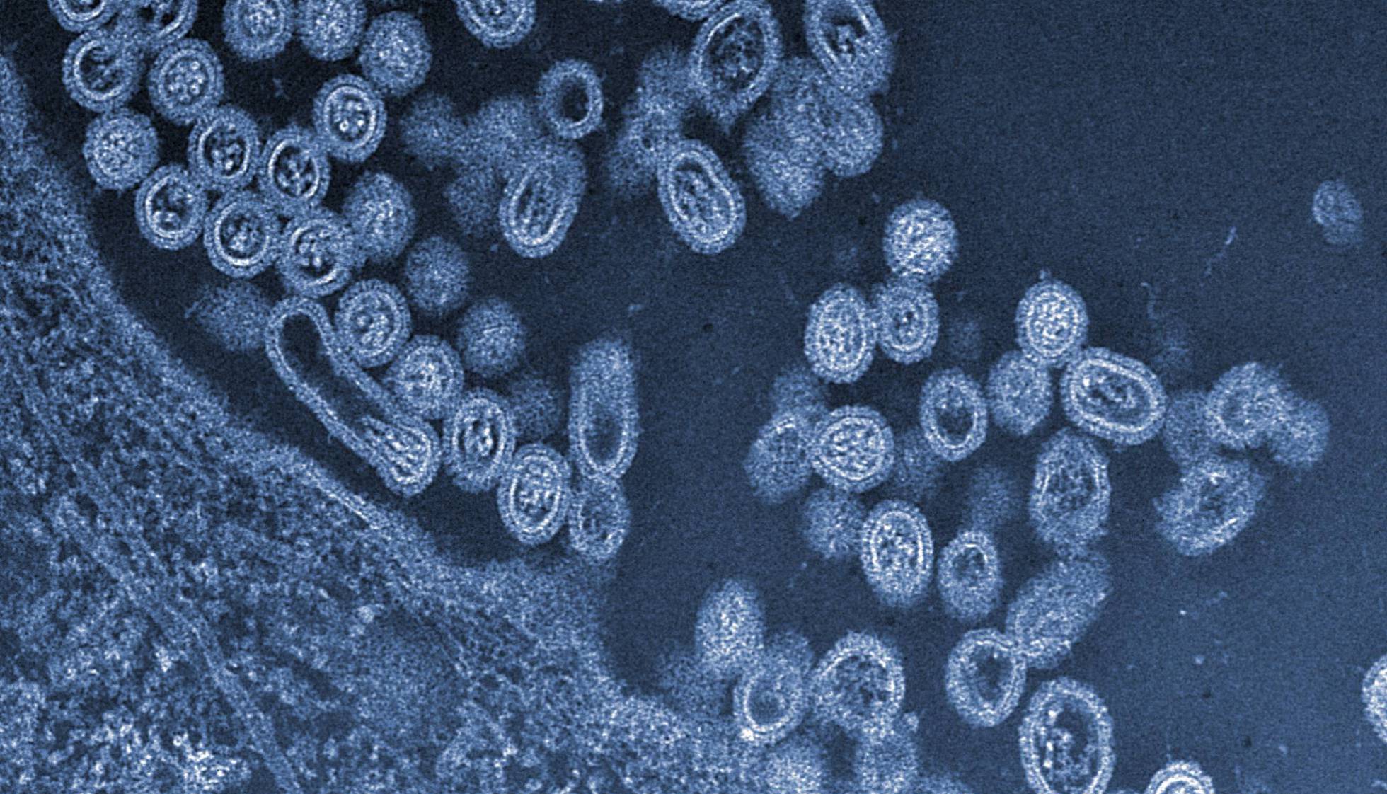Gripe Aviar H5N8