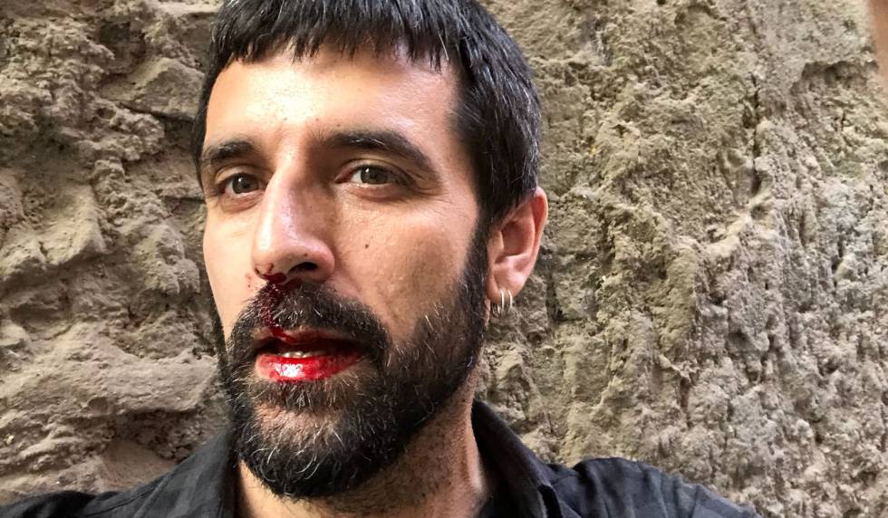 El fotoperiodista Jordi Borrà s, tras la agresión.