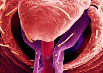 Desahuciando a los chinches