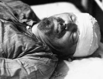 Trotski falleció en el hospital al día siguiente del ataque.