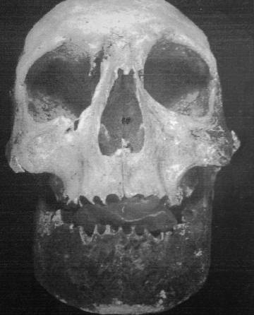Cráneo de Bermudo III.