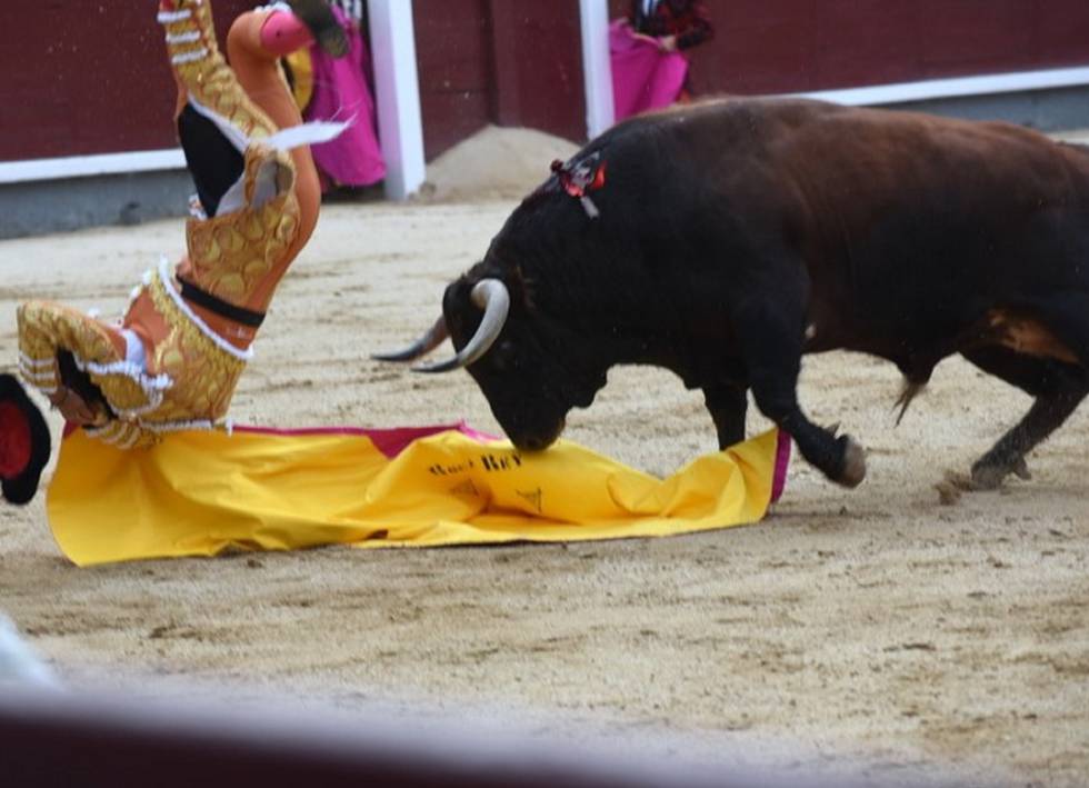 Quien opera las hernias cervicales
