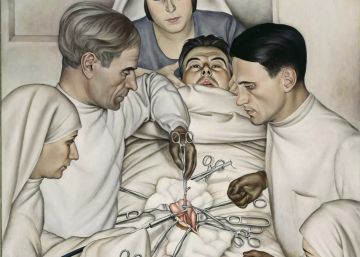 Lo primero que haremos