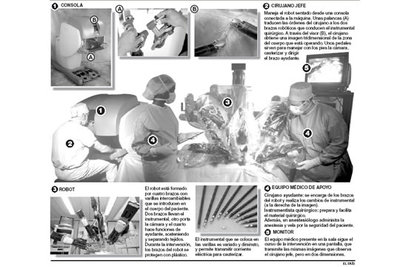 cirugía robótica de próstata modena de