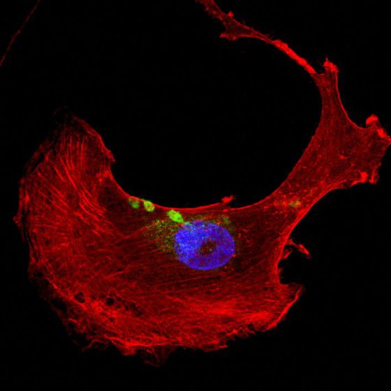 Células cardiacas de rata en las que se ha comprobado el daño que genera la mutación del gen 'FLNC' que portaban los pacientes