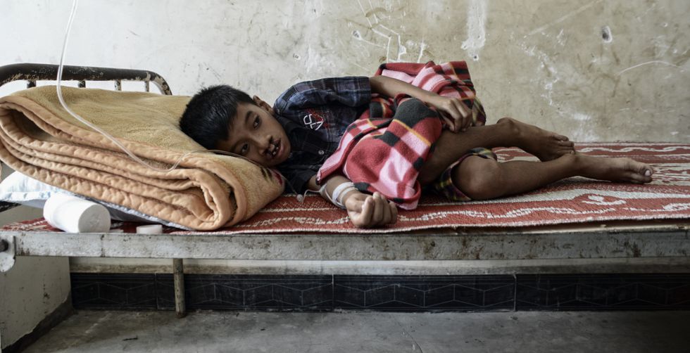 Un niño con paladar hendido espera a que el médico Nangzing Bawk le atienda. El hospital de Laiza ha tenido que cerrar el departamento de pediatría y carece de medios, así que no hay nada que puedan hacer por él.