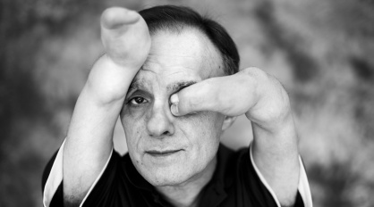 Víctimas de Talidomida