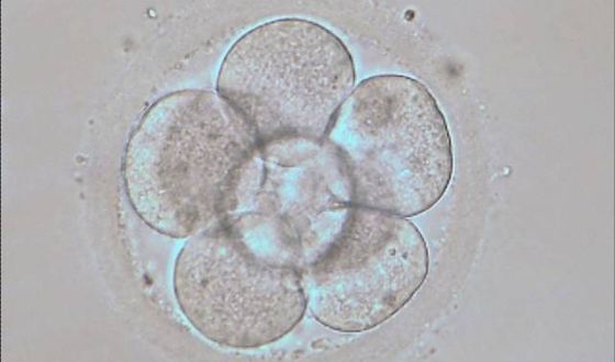 Embrión humano en estado de 8 células ( 3 días de desarrollo embrionario in vitro)
