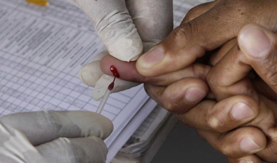Un hombre en Johannesburgo (Sudáfrica) se somete a una prueba rápida para detectar el VIH