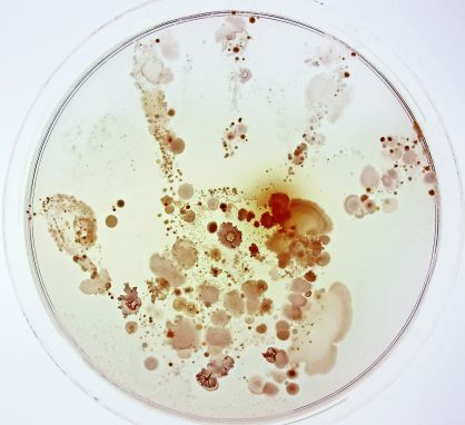 Las bacter&iacute;as en la mano de una ni&ntilde;a. 