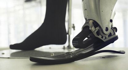 Un accidente de escalada tras el diseño de las mejores prótesis