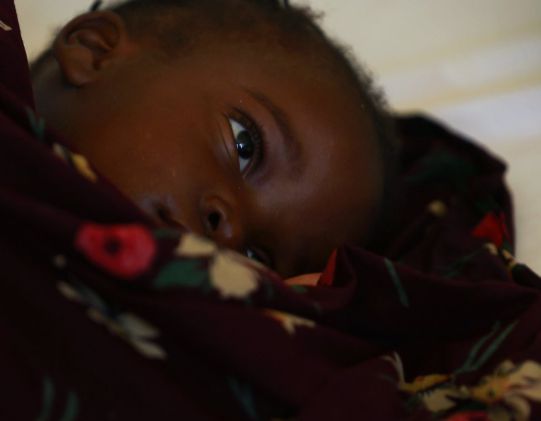 Niña enferma de malaria en Mozambique.